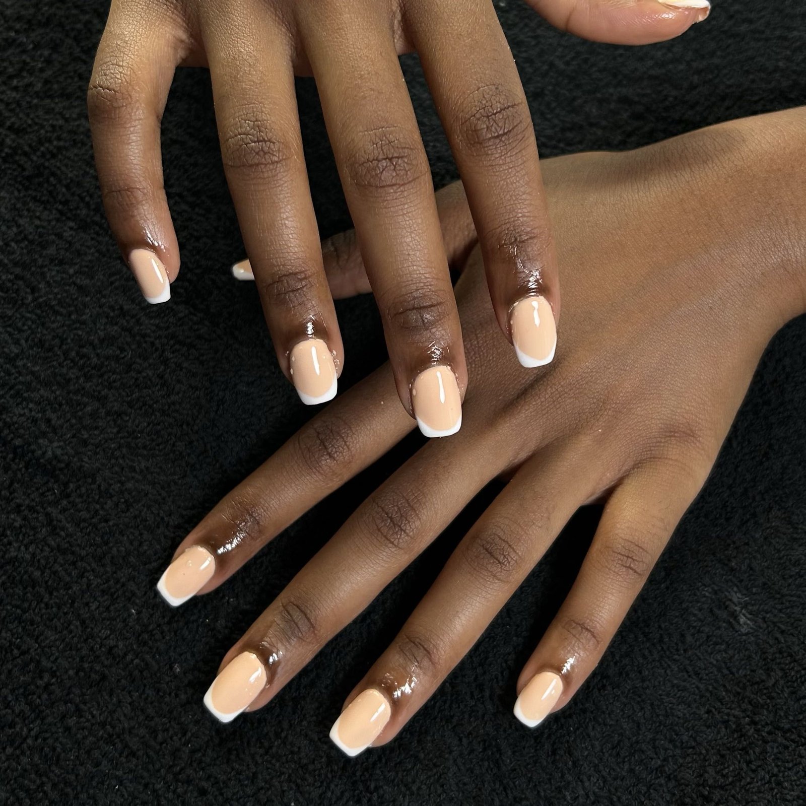 Gel Overlay